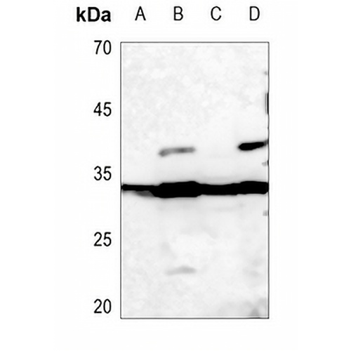 Histone H1.0 Rabbit Polyclonal Antibody
