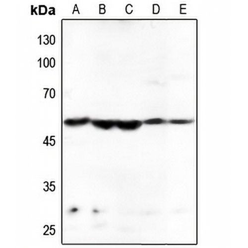 HARS Rabbit Polyclonal Antibody