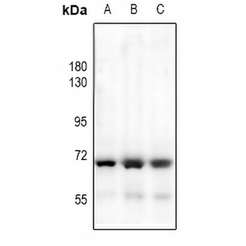 HEXB Rabbit Polyclonal Antibody