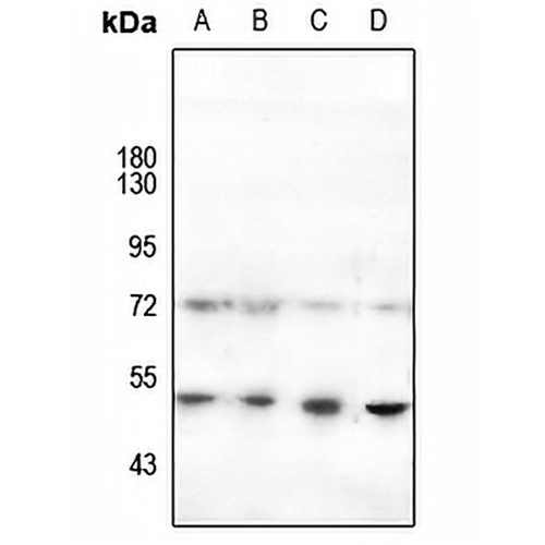 HNF4 alpha (Phospho-S313) Rabbit Polyclonal Antibody