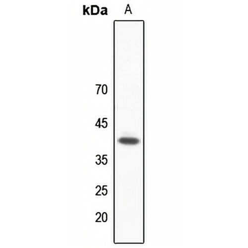 hNRNP C Rabbit Polyclonal Antibody