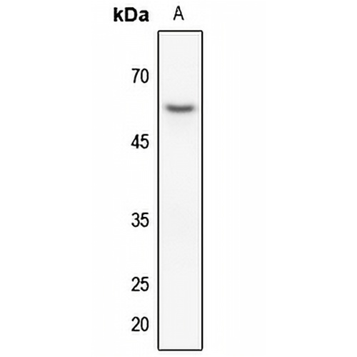 Cytokeratin 8 Rabbit Polyclonal Antibody