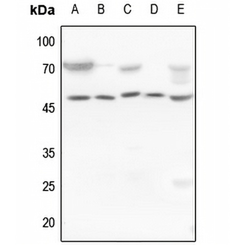 Cytokeratin 18 Rabbit Polyclonal Antibody