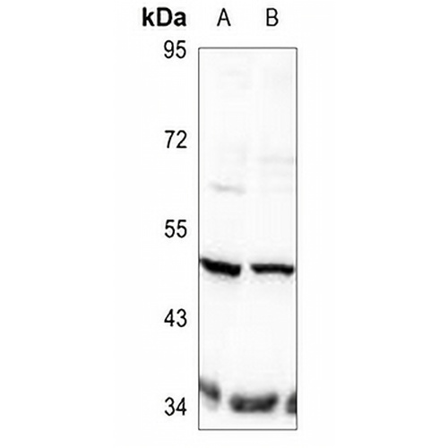 TAU (Phospho-T498) Rabbit Polyclonal Antibody