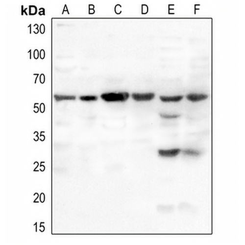 MDM2 (Phospho-S166) Rabbit Polyclonal Antibody