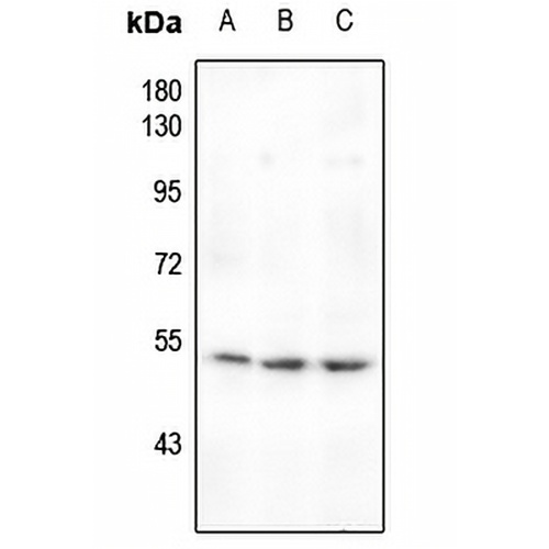 MEF2A (Phospho-T319) Rabbit Polyclonal Antibody
