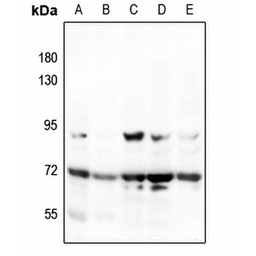 MEKK3 Rabbit Polyclonal Antibody