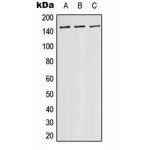 ASK1 Rabbit Polyclonal Antibody