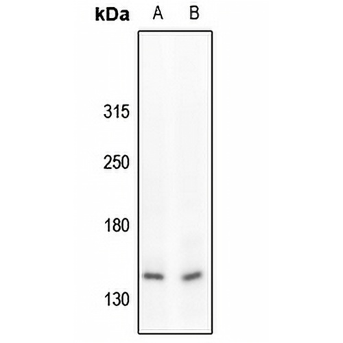 c-Met (Phospho-Y1234) Rabbit Polyclonal Antibody