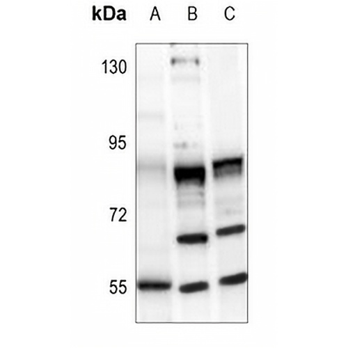 MMP16 Rabbit Polyclonal Antibody