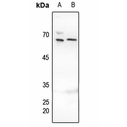 MUTYH Rabbit Polyclonal Antibody