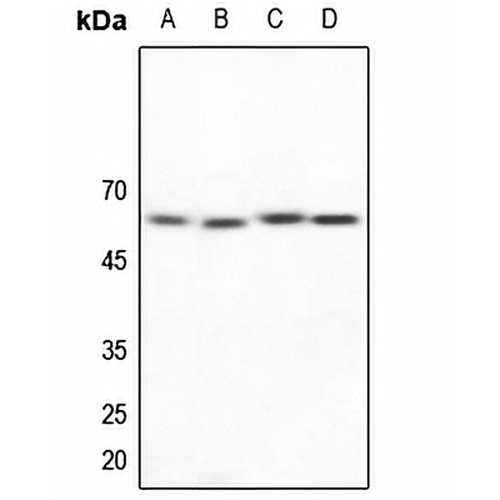 NAB2 Rabbit Polyclonal Antibody