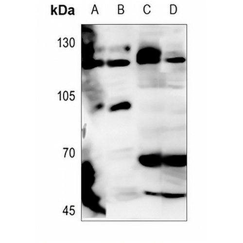 CD56 Rabbit Polyclonal Antibody