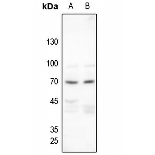 Merlin (Phospho-S518) Rabbit Polyclonal Antibody