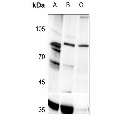 PLA2G4A (Phospho-S505) Rabbit Polyclonal Antibody