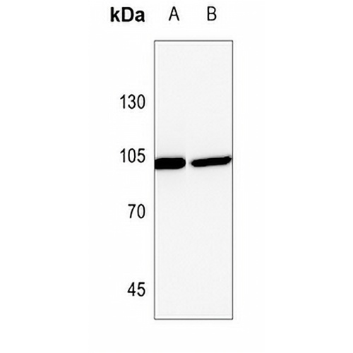 PLA2G4A Rabbit Polyclonal Antibody