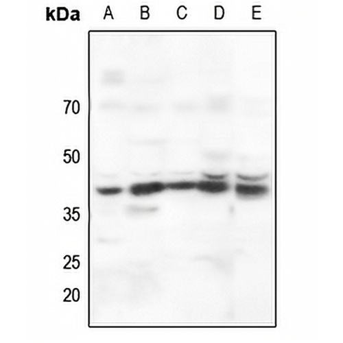 AMPK beta 1 Rabbit Polyclonal Antibody