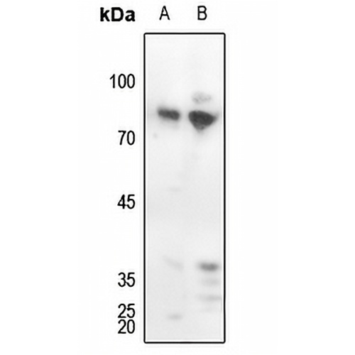 PKC delta (Phospho-Y313) Rabbit Polyclonal Antibody