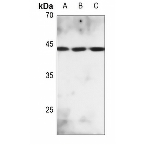 MKK2 (Phospho-T394) Rabbit Polyclonal Antibody