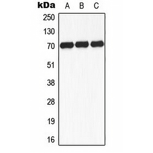 S6K1 (Phospho-S434) Rabbit Polyclonal Antibody