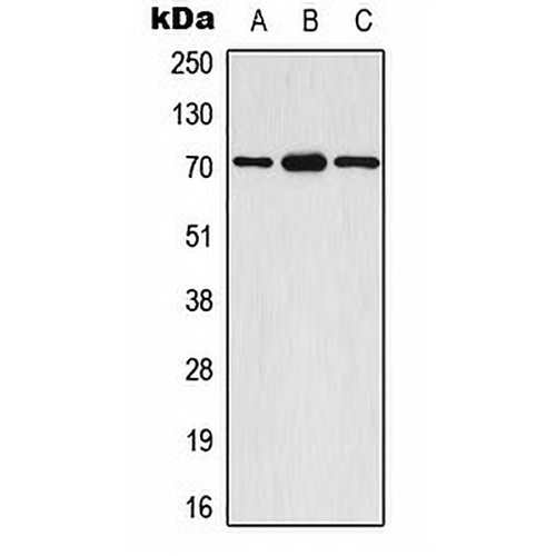 S6K1 (Phospho-S447) Rabbit Polyclonal Antibody