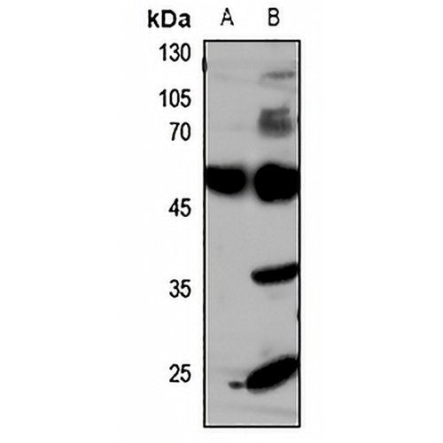 GLUT4 Rabbit Polyclonal Antibody