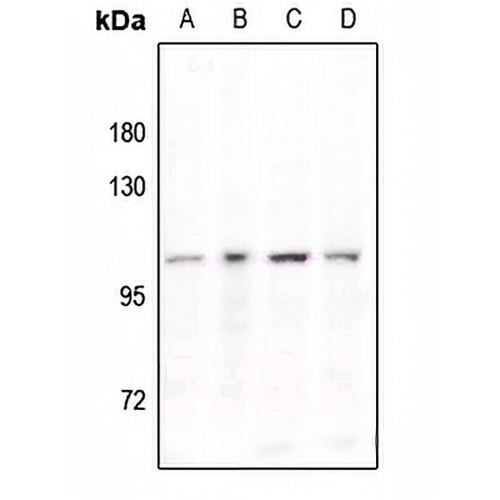 STAT6 (Phospho-Y641) Rabbit Polyclonal Antibody