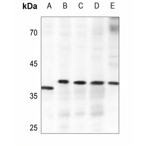 ELOVL4 Rabbit Polyclonal Antibody