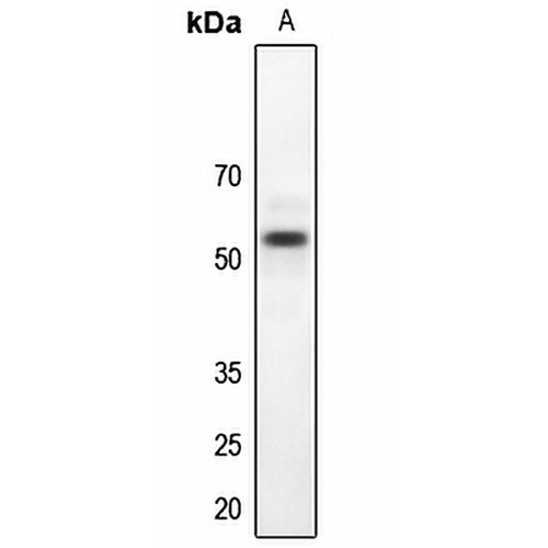 LKB1 Rabbit Polyclonal Antibody