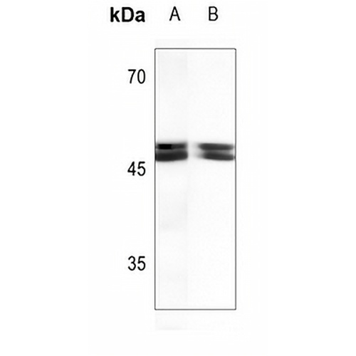 Thymine DNA Glycosylase Rabbit Polyclonal Antibody