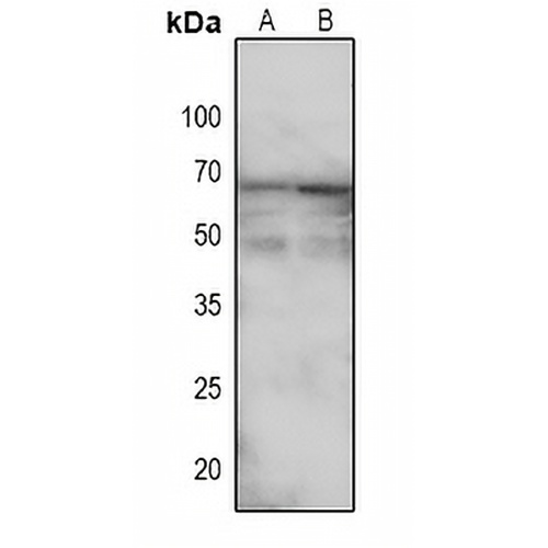 TGFBR2 (Phospho-S225) Rabbit Polyclonal Antibody