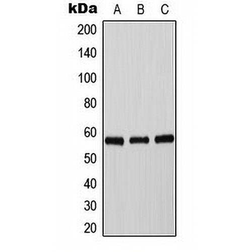Tyrosine Hydroxylase (Phospho-S71) Rabbit Polyclonal Antibody