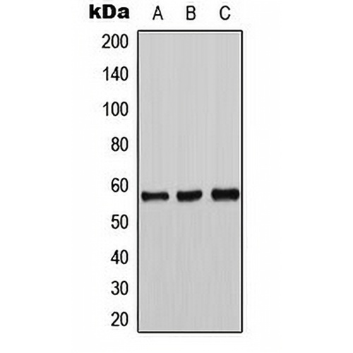 Tyrosine Hydroxylase Rabbit Polyclonal Antibody