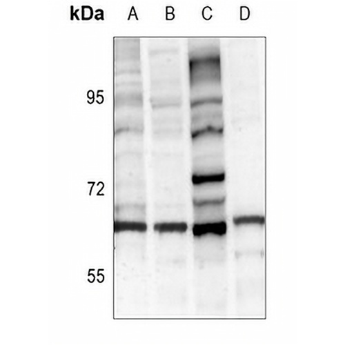 Tyrosine Hydroxylase Rabbit Polyclonal Antibody
