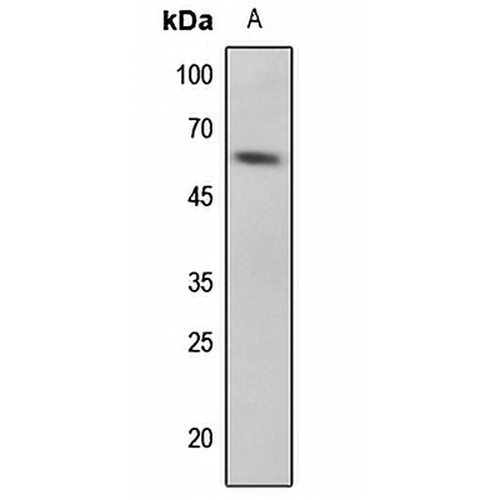 p53 (Phospho-S33) Rabbit Polyclonal Antibody