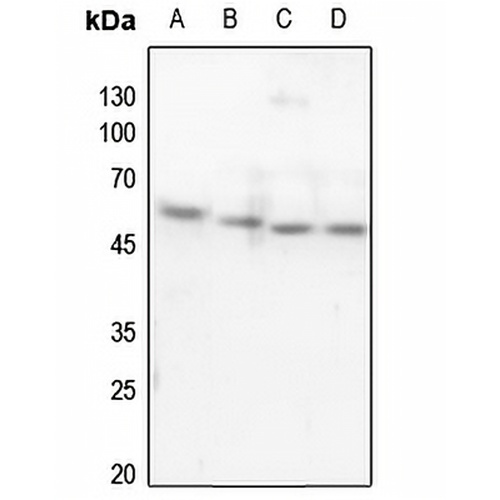 p53 Rabbit Polyclonal Antibody
