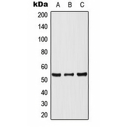 p53 Rabbit Polyclonal Antibody