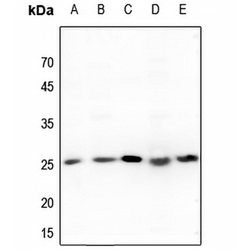 Translin Rabbit Polyclonal Antibody