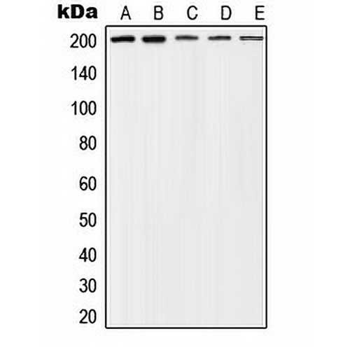 TSC2 (Phospho-T1462) Rabbit Polyclonal Antibody