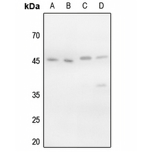 VASP (Phospho-S157) Rabbit Polyclonal Antibody