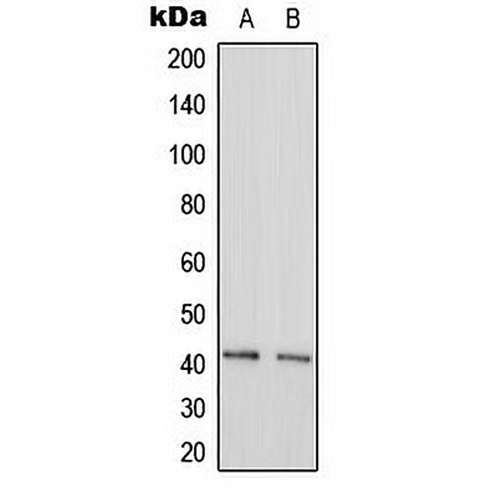 GAS41 Rabbit Polyclonal Antibody