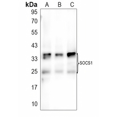 SOCS1 Rabbit Polyclonal Antibody