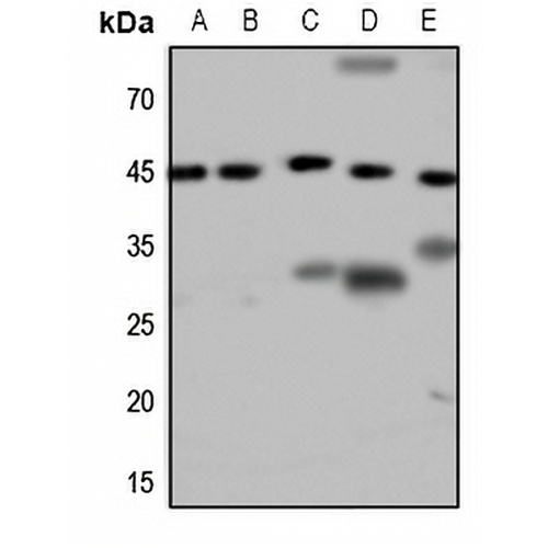 GALR2 Rabbit Polyclonal Antibody