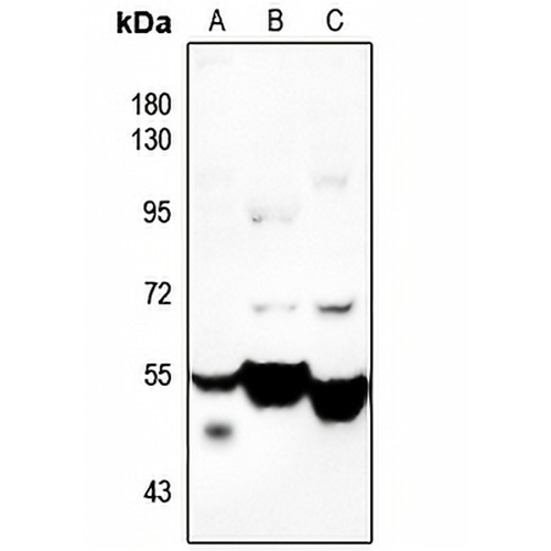 CDKL2 Rabbit Polyclonal Antibody