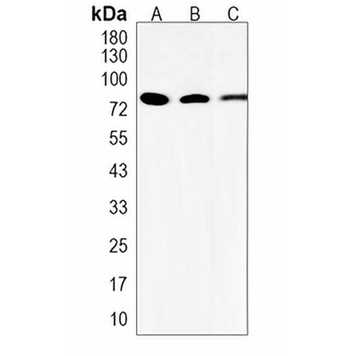 AKAP5 Rabbit Polyclonal Antibody