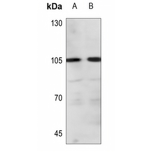 ADAMTS1 Rabbit Polyclonal Antibody