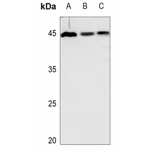 GDF15 Rabbit Polyclonal Antibody