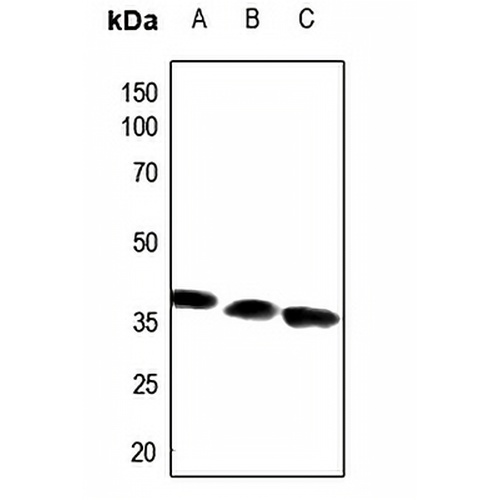 ACOT8 Rabbit Polyclonal Antibody