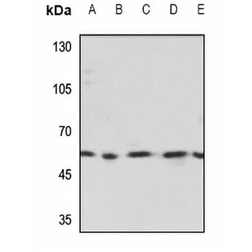 TESK2 Rabbit Polyclonal Antibody