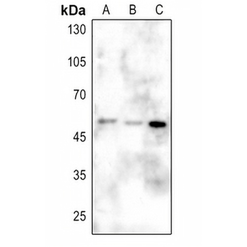 CD2BP2 Rabbit Polyclonal Antibody